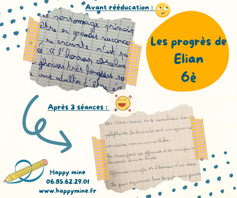 Les progr&egrave;s de Elian, 6&egrave;me apr&egrave;s 3 s&eacute;ances